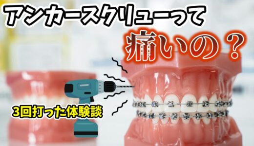 【アンカースクリューって痛い？】歯列矯正でアンカースクリュー3回打った体験談