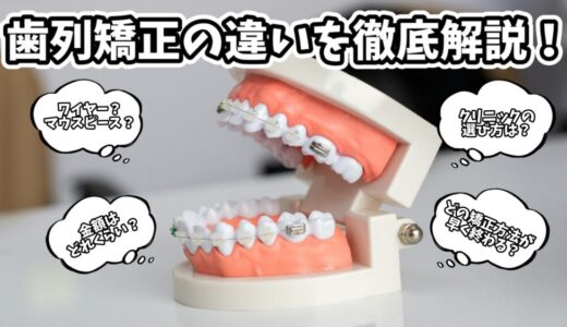 【2025年版】歯列矯正の種類と違いを徹底解説！筆者の体験談や正直な印象も解説