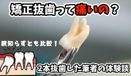 矯正のための抜歯って痛いの？親知らずの抜歯とは違う、矯正抜歯のリアル体験談！